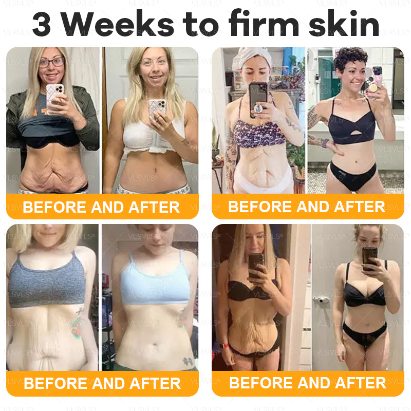 Made and Shipped from USA  🎄𝑽𝑳𝑺𝑽𝑳𝑺® Bee Venom Comprehensive Cream  LAST DAY 80% OFF(Sagging Skin, Fine Lines, Loss of Firmness, Flat Bust, Drooping Hips, and More)