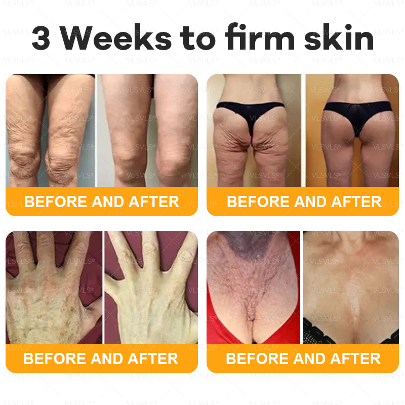 Made and Shipped from USA  🎄𝑽𝑳𝑺𝑽𝑳𝑺® Bee Venom Comprehensive Cream  LAST DAY 80% OFF(Sagging Skin, Fine Lines, Loss of Firmness, Flat Bust, Drooping Hips, and More)