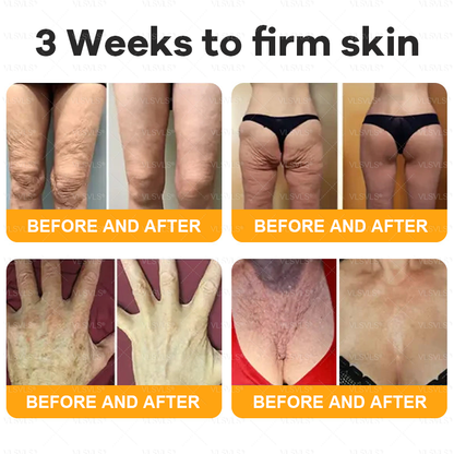 Made and Shipped from USA  🎄𝑽𝑳𝑺𝑽𝑳𝑺® Bee Venom Comprehensive Cream  LAST DAY 80% OFF(Sagging Skin, Fine Lines, Loss of Firmness, Flat Bust, Drooping Hips, and More)
