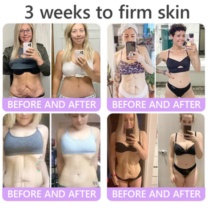HISKIN® 🎁🎁🎁Only 10 Boxes left! We're offering you an additional 30% discount! Get yourself in shape and healthy. Miss out now, and you won't have another chance until next year.