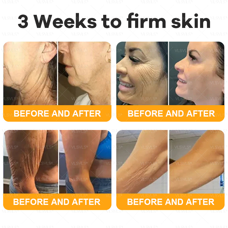 Made and Shipped from USA  🎄𝑽𝑳𝑺𝑽𝑳𝑺® Bee Venom Comprehensive Cream  LAST DAY 80% OFF(Sagging Skin, Fine Lines, Loss of Firmness, Flat Bust, Drooping Hips, and More)