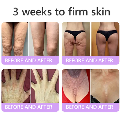 HISKIN® 🎁🎁🎁Only 10 Boxes left! We're offering you an additional 30% discount! Get yourself in shape and healthy. Miss out now, and you won't have another chance until next year.