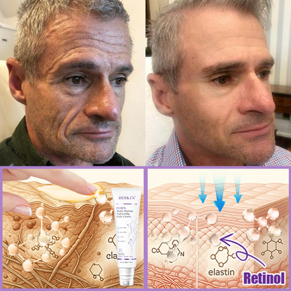 HISKIN® 🎁🎁🎁Only 10 Boxes left! We're offering you an additional 30% discount! Get yourself in shape and healthy. Miss out now, and you won't have another chance until next year.